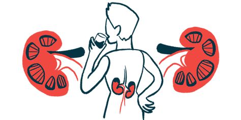 Pre-transplant PH Does Not Affect 5-year Survival After Kidney Transplant Kidney Biopsy, Acute Kidney Injury, Kidney Function, Kidney Damage, Western Medicine, Get Your Life, Chronic Illness, Better Sleep, Type 1