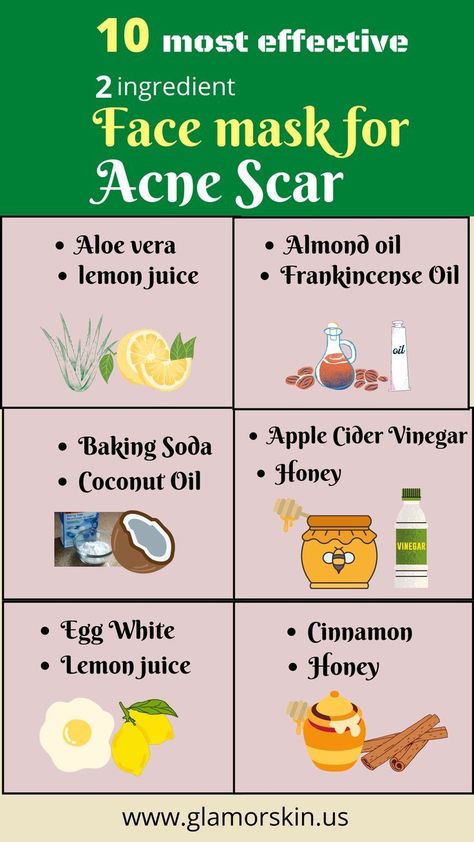 Face mask for Acne scar | Beauty tips | Acne & Pimples | GlamorSkin Pimple Scar Removal, Face Mask For Pimples, Masks For Acne, Face Mask For Acne, Pimple Free Skin, Acne Scar Mask, Mask For Acne, Remedies For Acne, Pimples Under The Skin