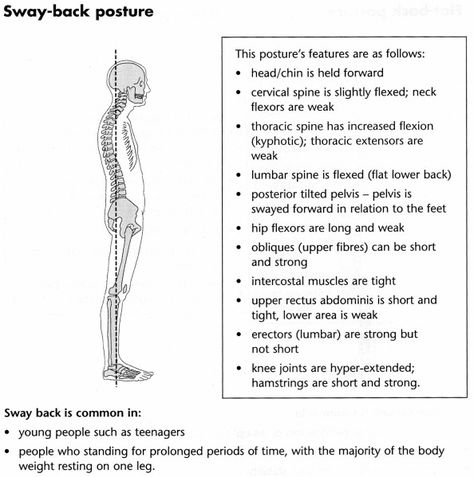 Sway Back Posture Sway Back Posture, Strengthen Hip Flexors, Activate Glutes, Strengthen Hips, Lower Back Pain Stretches, Sore Hips, Hip Flexor Exercises, Sway Back, Hanging Leg Raises