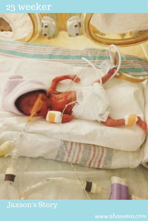 While many hospitals consider 24 weeks viability for babies, some hospitals are saving babies even earlier. Today, meet a 23 weeker that has beat all the odds. Nicu Doctor, Preemie Babies Pictures, Doctor Dream, Neonatal Nursing, Nicu Nursing, Charity Sewing, Premie Baby, Preterm Labor, Sweet Pictures