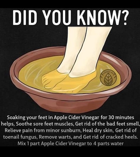 Transform your foot care routine with the natural benefits of an apple cider vinegar foot soak. This simple yet effective remedy can help soothe tired feet, soften calluses, and even combat foot odor. Rich in acetic acid, apple cider vinegar works wonders in exfoliating dead skin and balancing the skin's pH levels. Perfect for a relaxing evening at home, this foot soak is a must-try for anyone looking to pamper their feet while enjoying the holistic benefits of this versatile ingredient. Give your feet the care they deserve and experience the rejuvenating effects firsthand. Apple Cider Vinegar Foot Soak, Vinegar Foot Soak, Skincare For Teens, Coconut Health, Sickness Remedies, Healing Motivation, Life Tips And Tricks, Diy Detox, Homemade Wrinkle Cream