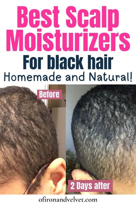 The 4 Best scalp moisturizers for black hair: Easy, cheap and home-made - Of Iron and Velvet Dry Hair Remedies For Black Women, Good Moisturizer For Natural Black Hair, Alopecia Hairstyles Black Women, Thinning Hair Black Women, Fenugreek Water, Dry Hair Products, Hair Masks For Hair Growth, Masks For Hair Growth, Scalp Spa