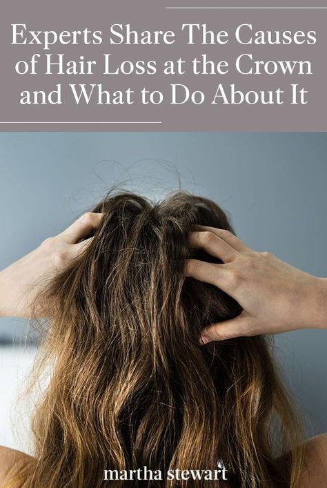 How To Help Itchy Scalp, Products For Itchy Scalp, Flaky Scalp Remedy, Psoriatic Scalp, Hair Thinning At Crown, Extremely Dry Scalp, Red Scalp, Itchy Scalp Causes, Scaly Scalp