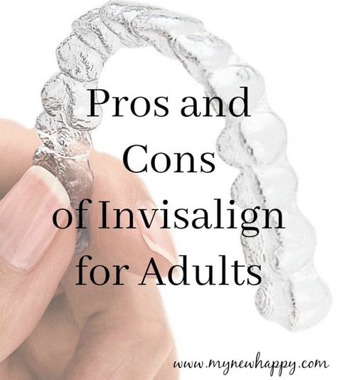 Teeth Aligners Before And After, Invisaline Before And After, Invisalign Tips And Tricks, Invisalign Before And After, Invisalign Aesthetic, Before And After Invisalign, Overbite Before And After, Invisalign Hacks, Invisalign Tips