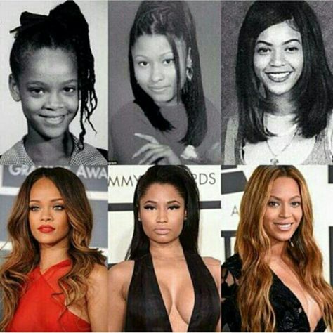 Follow @badgalronnie Beyonce And Nicki Minaj, Beyonce And Nicki, Rihanna Nicki Minaj, Beyonce Nicki Minaj, Nose Jobs, Nicki Minaj Pictures, Photo Star, Queen Bey, Rihanna Fenty