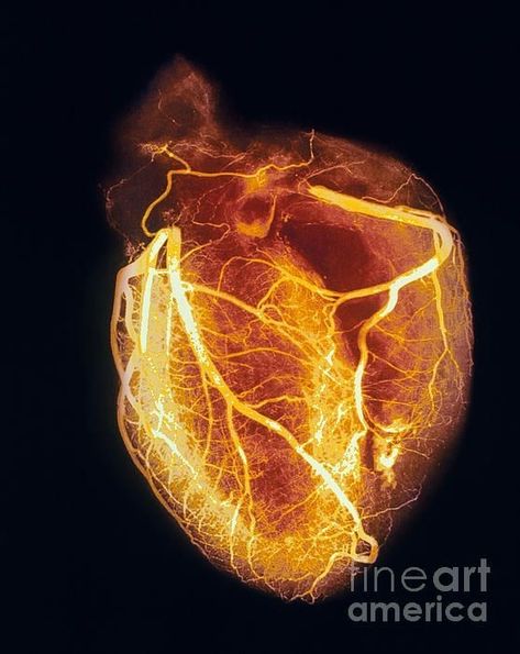 Cardiovascular Anatomy, Coronary Arteries, Anatomy Physiology, Heart Pictures, Human Heart, Cardiology, Foto Art, Medical Science, Anatomy And Physiology