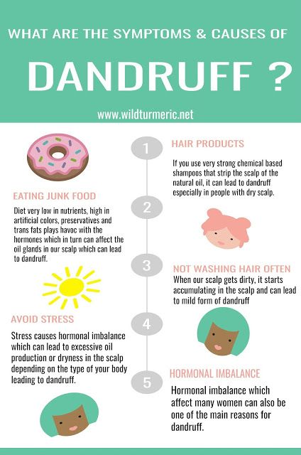 How To Remove Dandruff From Scalp, Dandruff Tips, What Is Dandruff, What Causes Dandruff, How To Remove Dandruff, Kaba Styles, Natural Dandruff Remedy, Dandruff Causes, Home Remedies For Dandruff