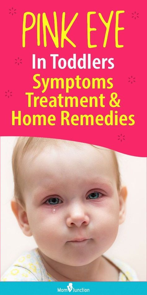 5 Eye Problems To Never Ignore Natural Remedies For Pink Eye In Kids, Pink Eye In Kids, Pink Eye Remedy For Kids, Pink Eye In Toddlers, Red Eyes Remedy, Pink Eye Remedies, Pink Eye Remedy, Goopy Eyes, Treating Pink Eye