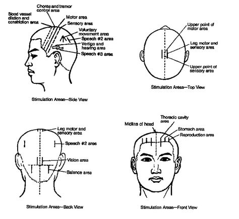 why put needle in the forearm accupunc - Google Search Mind Connection, Thoracic Cavity, Heart Diagram, Hand Reflexology, Acupuncture Points, Acupressure Points, Health Ideas, Traditional Chinese Medicine, Pressure Points