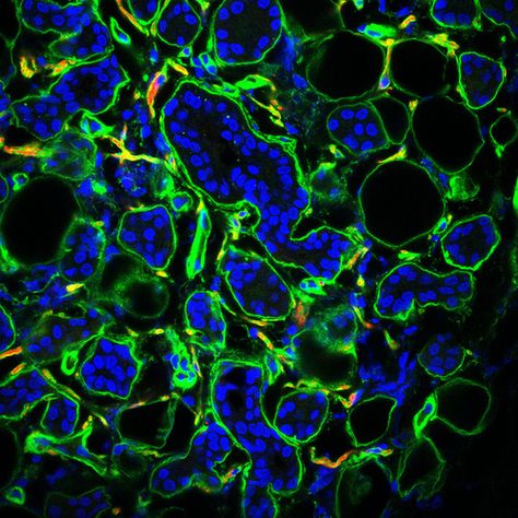 Confocal image of human parotid using fluorophores Cy3 (neurotubulin), Cy2 (perlecan basement membrane), Hoechst (nuclei). Acinar units produce saliva. Cells Under Microscope, Human Cells Microscope, Microscopic Plant Cells, Microscopic Cells, Parotid Gland, Fluorescence Microscopy, Confocal Microscopy, Basement Membrane, Electron Microscope Images