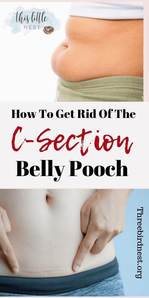 How To Eliminate Your "Mummy Tummy" After A C-Section | This Little Nest Saggy Belly, C Section Belly, C Section Workout, Tummy Pooch, Post Baby Workout, Mummy Tummy, Post Pregnancy Workout, Pregnancy Belly, Belly Pooch