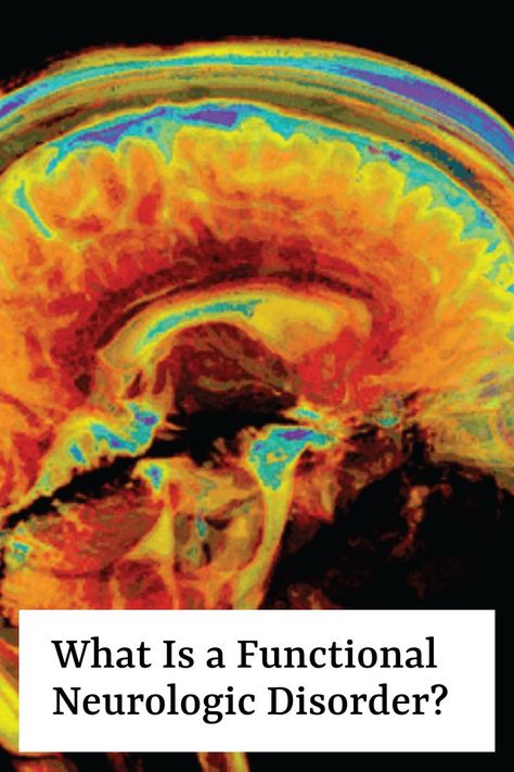 Functional neurologic disorder (FND) refers to a group of motor, sensory, or cognitive symptoms caused by an abnormality in how the brain functions. FND is distinct from other neurologic conditions such as epilepsy, stroke, and multiple sclerosis in that there is no overt structural damage in the brain. It's a dysfunction of the connections within the brain (the “software”) rather than the structure of the brain itself (the “hardware”). Fnd Symptoms, Neuro Disorders Nursing, Fnd Awareness, Lesions On Brain, Functional Neurological Disorder, Brain Issues, Nerve Disorders, Conversion Disorder, Brain Rewiring Neuroplasticity