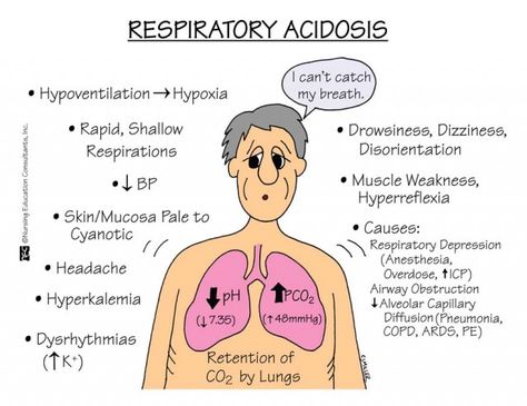 Respiratory Acidosis Nursing Management - Nurseslabs Respiratory Nursing, Nursing Respiratory, Acidosis And Alkalosis, Respiratory Alkalosis, Nursing Tools, Respiratory Acidosis, Nurse Education, Nursing Fun, Nursing Information