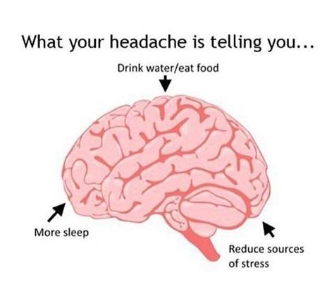 What your headaches are telling you. 1000 Lifehacks, 1000 Life Hacks, Simple Life Hacks, Diy Life Hacks, Diy Life, The More You Know, Useful Life Hacks, Migraine, The Brain