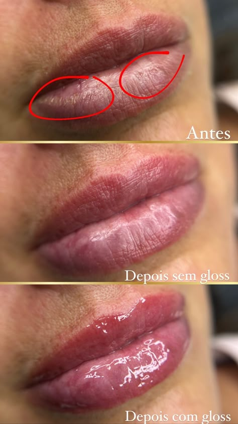 Skin Bar, Brow Tutorial, Beauty Studio, Skin Care Solutions, Lip Glow, Lash Lift, Lip Gloss, Lashes, Facial