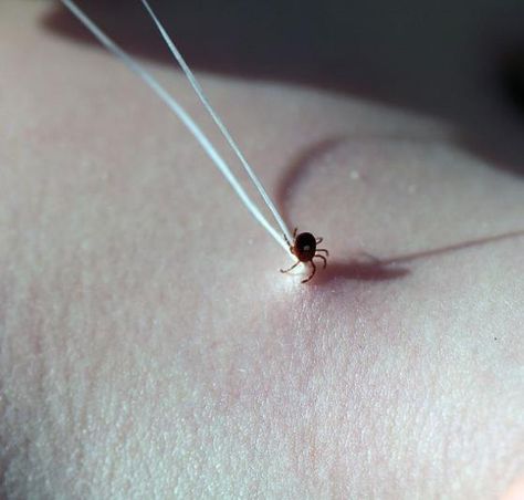 Yikes! Ticks are gross! Here's how to quickly & easily remove one properly! Removing Ticks, How To Get Ticks Off Dogs, How To Remove Ticks From People, Removing Ticks From Dogs, Removing A Tick From A Person, Essential Oils For Ticks, Tick Removal, Tick Bite, Tick Repellent