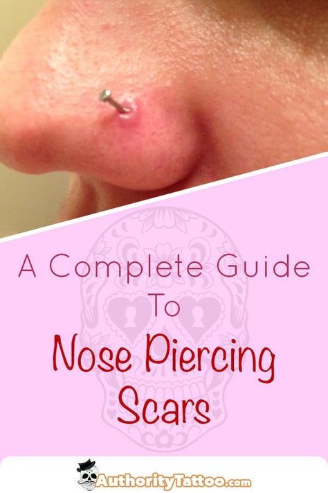 Nose Piercing Care, Nose Piercing Scar, Small Nose Piercing, Nose Piercing Healing, Nose Piercing Bump, Piercing Bump, Cute Nose Piercings, Nose Piercing Stud, Small Nose