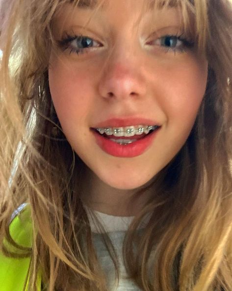 lily pearl crosland 🤍 en Instagram: “i had such a long day today” Girl With Braces, Girls With Braces, Braces Smile, Cute Braces Colors, Pretty Teeth, Braces Tips, Getting Braces, Braces Girls