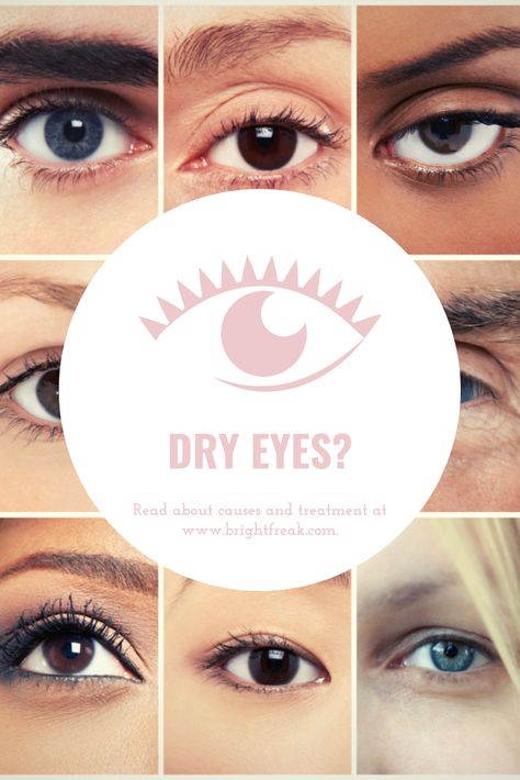 No matter the cause of the problem, read on to see remedies for dry eyes. We guarantee, there won’t be a dry eye in the place when we’re done. Dry Eye Remedies, Posterior Vitreous Detachment, Eye Twitching, Sjogrens Syndrome, Nail Problems, Dry Eyes Relief, Dry Eye, Eye Sight Improvement, Eye Exercises