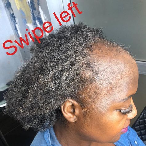 RAZOR CHIC on Instagram: “Freedom is a powerful thing..... It’s been over 2 decades since this beauty has worn her own hair. As u can see she suffers from ALOPECIA.…” Razor Chic, Freedom Is, U Can, About Hair, Beautiful Hair, Natural Hair, Style Me, Natural Hair Styles, Coco