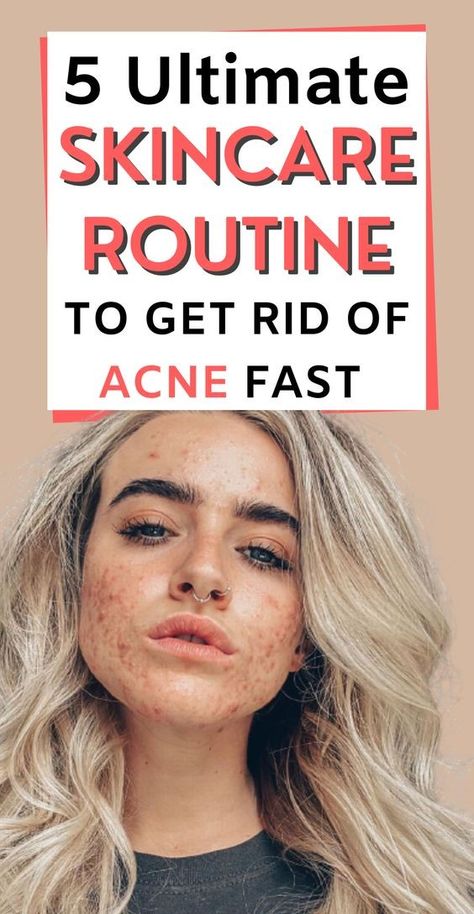 Scalp Spa, Face Cleaning Routine, Skincare Routine For Acne, Face Washing Routine, Simple Skin Care Routine, Skin Care Routine For Acne, Acne Routine, Sensitive Acne Prone Skin, Facial Routine Skincare