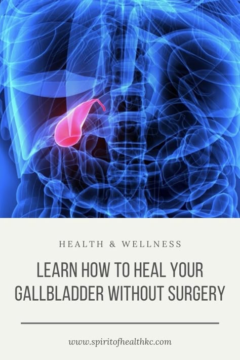 Foods Good For Your Gallbladder, Gallbladder Symptoms In Women, Gallbladder Healthy Foods, Gal Bladder Cleanse, Gallbladder Flush Recipe, Foods To Heal Your Gallbladder, Gall Bladder Health, Gallbladder Diet Sweets, Gallbladder Stones How To Get Rid