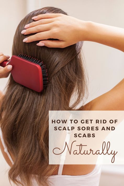 Sores On Scalp Remedies, Sebaceous Cysts On Head Scalp, Scabs On Scalp How To Get Rid Of, Scalp Breakouts Remedies, Scabs On Scalp, Scalp Sores, Scalp Scabs, Scalp Bumps, Sores On Scalp