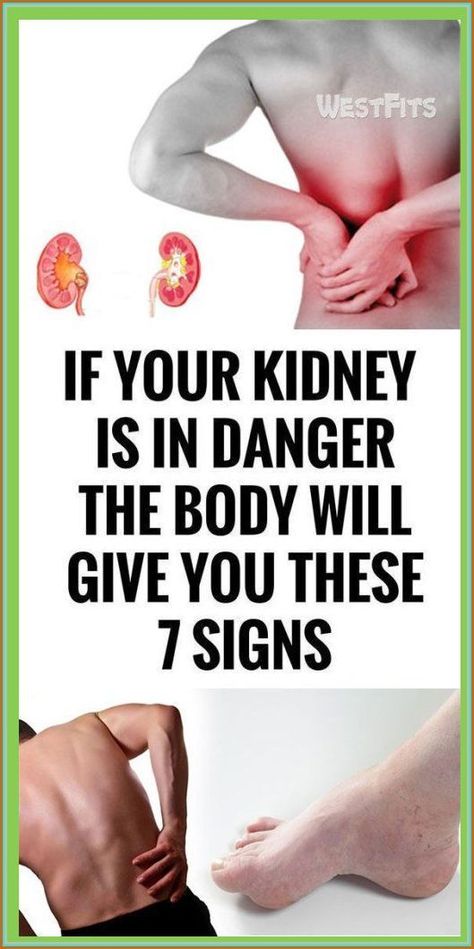 For your health, the kidneys are essential because they detoxify and cleanse the body by filtering 10-150 quarts of blood in a day. Their location is under the rib cage. Their function is to elimin Coconut Health, Kidney Health, What Happened To You, Health Remedies, Health Problems, Womens Health, The Body, Belly Fat, Home Remedies