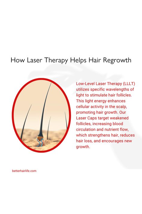 How does laser therapy help hair regrowth? 🌟   Low-Level Laser Therapy (LLLT) uses specific wavelengths of light to stimulate hair follicles, enhancing cellular activity in the scalp. Our Laser Caps target weakened follicles, increasing blood circulation and nutrient flow, which strengthens hair, reduces hair loss, and encourages new growth.   #HairGrowth #LaserCap #BetterHairLife #HairCare #HealthyHair #BeautyTech #DoctorApproved #HairRegrowth #LaserTherapy #BeautyScience Low Level Laser Therapy, Beauty Science, Stimulate Hair Follicles, Hair Follicles, Laser Therapy, Light Energy, Hair Regrowth, Promotes Hair Growth, Hair Strengthening