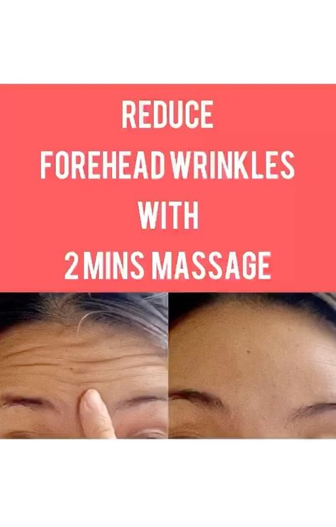 Face Muscle Massage / Exercise ✨Health and Beauty by U on Instagram: “Reduce forehead wrinkles with 2 minutes massage ✨ One of the way to reduce forehead wrinkles is take the tension off from the forehead…” Reduce Forehead Wrinkles, Natural Wrinkle Remedies, Hands Giving, Wrinkles Under Eyes, Remedies For Glowing Skin, Homemade Wrinkle Cream, Celebrity Skin Care, Wrinkle Remedies, Get Rid Of Wrinkles