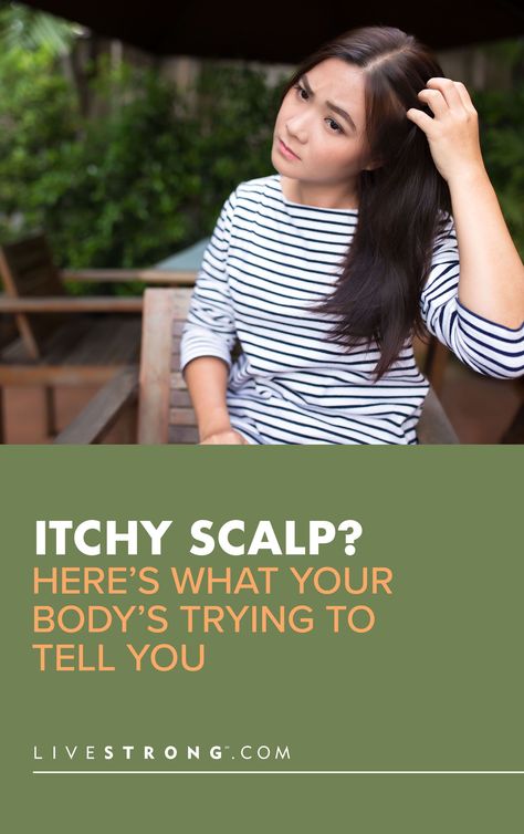 How To Stop Itchy Scalp, Dry Itchy Scalp Remedy, Itchy Dry Scalp Remedy, Itchy Scalp Causes, Itchy Head, Itchy Body, Itchy Scalp Remedy, Sores On Scalp, Shampoo For Itchy Scalp