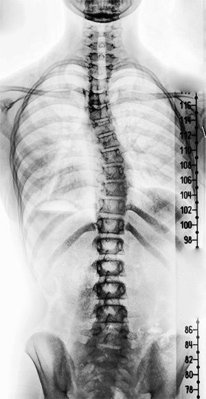 Xray Art, Hospice Nurse, Medical Illustration, Skeletal, Anatomy Art, Human Anatomy, Skull And Bones, X Ray, Taxidermy