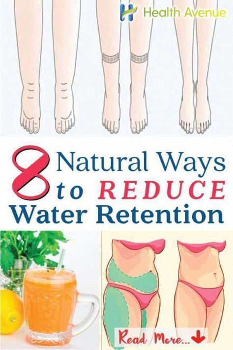 8 Natural Ways to Reduce Water Retention #reduceweight #HealthTips #HealthAdviceLine #NaturalRemediesImpetigo #AsthmaNaturalRemedies #HealthyFoodForHealthyLife #HealthMagazine How To Reduce Water Retention, Reduce Water Retention, Water Retention Remedies, Water Retention, Health Magazine, Hot Flashes, Health Advice, Reduce Weight, Dull Skin