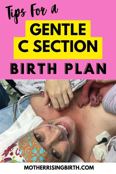 Learn about a gentle c section and make it happen with a cesarean birth plan! Walk through a cesarean birth step-by-step to know what to expect, but also learn from other moms about how to create an experience that is family centered leaving everyone feeling more satisfied. Use these tips to write a birth plan for a family centered gentle c section. Click through for all the details! Gentle C Section, C Section Birth Plan, Birth Plan Examples, Birth Board, Holistic Pregnancy, Holistic Fertility, Planning For Baby, Extended Breastfeeding, Gentle Discipline