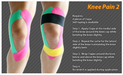 Taping Knee For Pain, Knee Taping For Pain, Kinesiology Taping Knee, Kinesio Taping Knee, Knee Taping, K Tape, Kinesio Tape, Kt Tape, Knee Pain Exercises