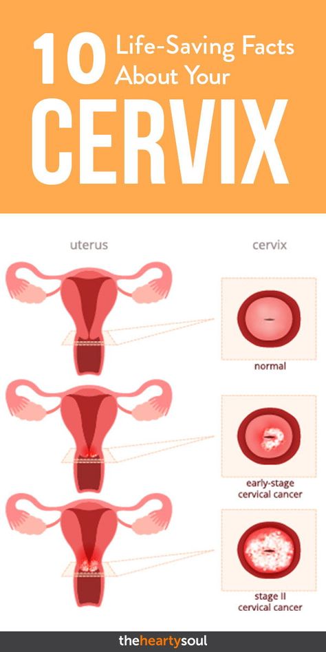 Cervix Pictures, Cervix Dilation, Medical Knowledge, Women's Health, Natural Living, Belleza Natural, Real Food, Saving Lives, New Ideas