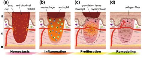 Wound Healing Stages, Granulation Tissue, Medical Study, Medical Notes, Epidermal Growth Factor, Nursing Process, Skin Grafting, Family Nurse Practitioner, Collagen Fibers