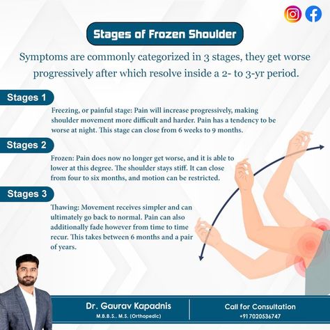 Frozen Shoulder, A Doctor, Frozen, Signs