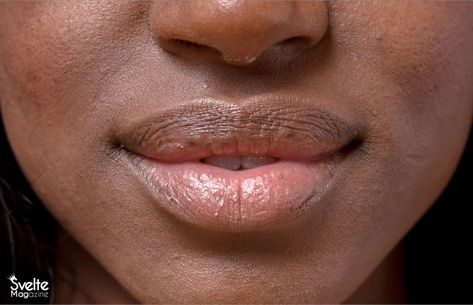 This post What to Do When Your Lips are Peeling written by Nelly Henshaw appeared first on Svelte Magazine - Top Nigerian Fashion Blog where you get Style and Beauty Tips. Ever had parched and chapped lips even when it’s not harmattan season? This alone is embarrassing especially when someone asks you, as a way of suggesting help, to go apply some lip balm. The worst is when the lips keep breaking even when you have some lipstick on. To save you from walking about with […] The post W Lips Peeling, Nigerian Fashion, Cracked Lips, Peeling Skin, Chapped Lips, Hemp Seed Oil, Your Lips, Dead Skin, Save You