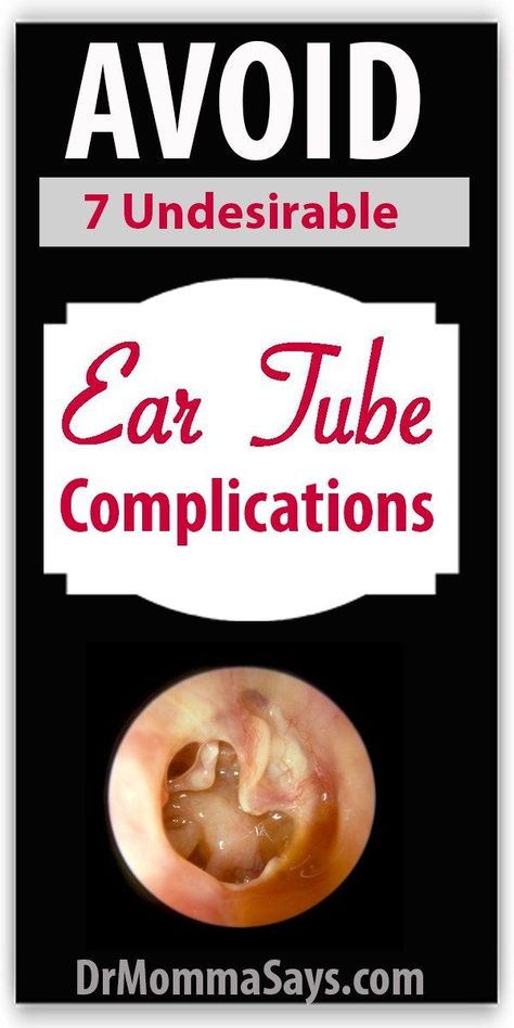 Ear Drainage, Fluid In Ears, Ear Tubes, Granulation Tissue, Hearing Problems, Speech Delay, Sinus Infection, Hearing Loss, Hearing Aids