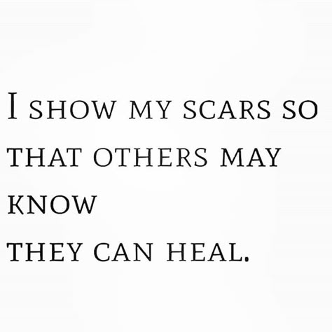 Reposting @vilina.christoph: Beautiful quote, isn't it? 💯 Aren't we all scarred (and scared)? I think we are. I think we're all wounded and in need of healing. We're not much different from one another and that's the beauty of it 👩‍❤️‍👨👨‍❤️‍👨👩‍❤️‍👩 If we show our scars and imperfections more openly, without being ashamed, we give permission to others to do the same and break free from the stigmas and dogmas of societal (and all other types) conditioning. Make it your mission and purpose Being Imperfect Quotes, We’re Different Quotes, We Aren’t The Same Quotes, Isolating To Heal Quotes, Were Not The Same Quotes, We Are All Different Quotes, We Are All The Same Quotes, We Not The Same Quotes, Healing Others Quotes