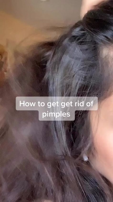 Get Rid Of Pimples, Rid Of Pimples, Haut Routine, Good Skin Tips, How To Get Rid Of Pimples, Basic Skin Care Routine, Beauty Tips For Glowing Skin, Clear Skin Tips, Perfect Skin Care Routine