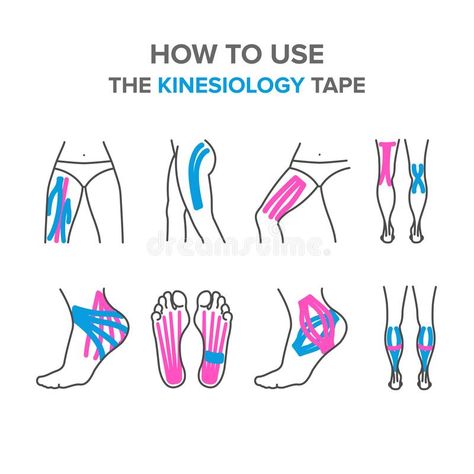 How to use the kinesiology tape. Kinesiology taping of the legs, knees, foot, tendon, ligaments vector illustration K Tape, Kt Tape, Kinesio Taping, Sports Tape, Kinesiology Taping, Muscle Contraction, Trigger Points, Sports Medicine, Muscle Relaxer