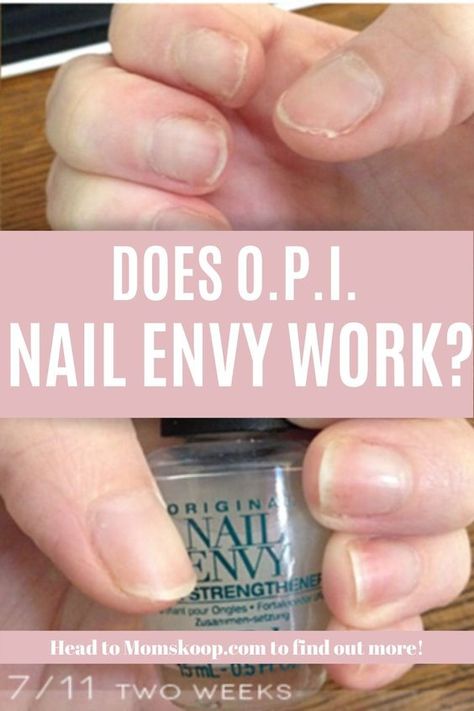 Natural Nails After Acrylic, Best Manicure For Healthy Nails, Opi Nail Envy Before And After, Strengthen Nails After Gel, How To Strengthen Weak Nails, Best Nail Strengthener Products, Natural Nail Health, Stronger Nails How To Get, Strengthen Natural Nails