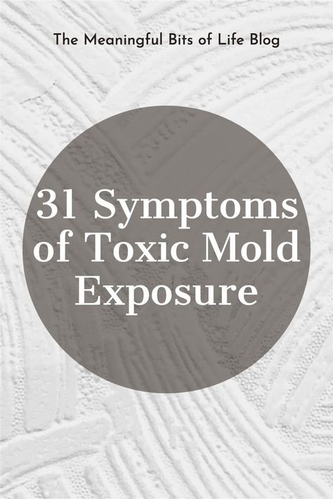 Toxic Mold Symptoms, Best Cough Remedy, Toxic Mold, Mold Exposure, Summer Health, Natural Sleep Remedies, Sinus Infection, Natural Cough Remedies, Daily Health Tips