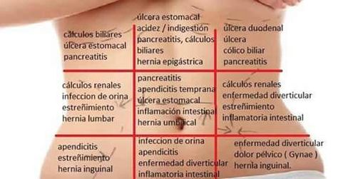 Dolor abdominal.posibles causas segun ubicación Medicine Notes, Medical School Motivation, Medicine Student, Anatomy Study, Abdominal Fat, Nursing Notes, Natural Therapy, School Motivation, Medical Students