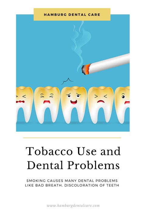 Smoking causes oral issues, like bad breath, discoloration of teeth and other long-term dental problems, read full blog to know more   #DentalTips #DentalHealth #Smoking #Tobacco #DentalProblems Dental Decay, Dental Tips, Teeth Health, Stronger Teeth, Dental Problems, Teeth Care, Tooth Decay, Dental Health, Oral Health