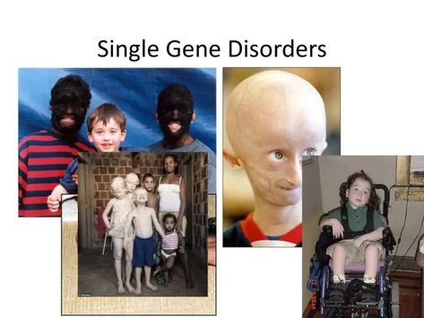 Polygenic inheritance vs Single gene inheritance, Non-mendelian inheritance and Genomic imprinting Polygenic Inheritance, Mendelian Inheritance, Myotonic Dystrophy, Chromosomal Disorders, Prader Willi Syndrome, Chromosomal Abnormalities, Mitochondrial Dna, Rare Disorders, Dna Sequence