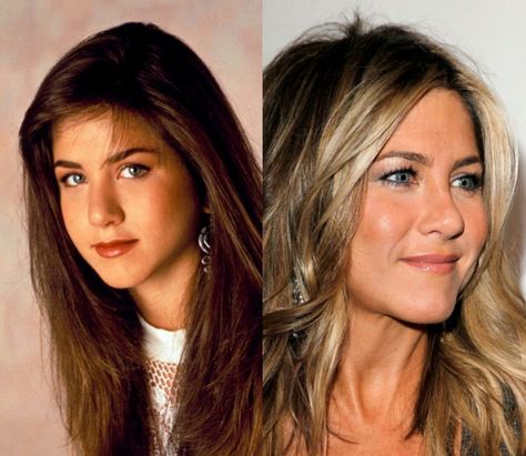 Jennifer Aniston nose job Jennifer Aniston Nose Job, Jennifer Aniston Nose, Nose Jobs, Jenifer Aniston, Button Nose, Nose Job, Friends Tv, Plastic Surgeon, Cosmetic Surgery