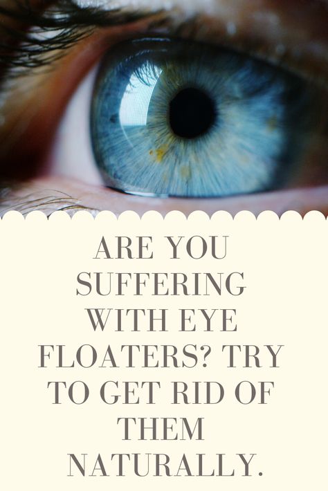 How To Get Rid Of Floaters In Your Eyes, How To Get Rid Of Eye Floaters, Eye Floaters Remedies Natural Treatments, Eye Floaters Remedies, Floaters In The Eye, Lazy Eye Exercises, Proverbs 3 7, What Causes Eye Floaters, Eye Bag Remedies